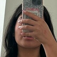 Бабјави Голе