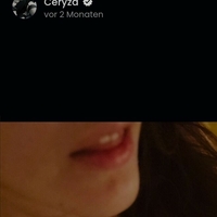 Цериза Голе