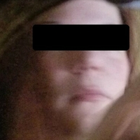 Крисбанекс Голе