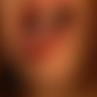 Дајга Корме Голе