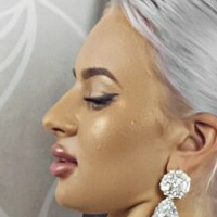 Флорина Голе