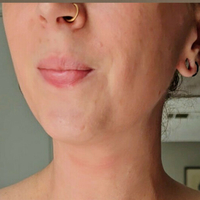 хотмомнекстдор11 Голе