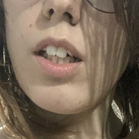 лолитакивис Голе