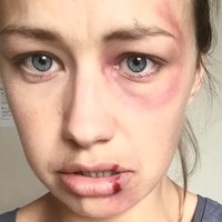 Лорна Демпси Голе