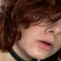 Миасма Х Голе