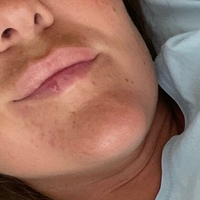 палавa катарина фри Голе