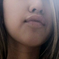 Никтонглерт Голе