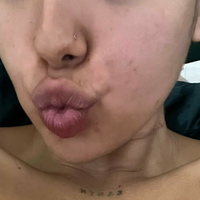 notyourbabyt Голе