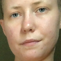 Тејл Мит Голе