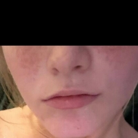 Вера 04 05 Голе